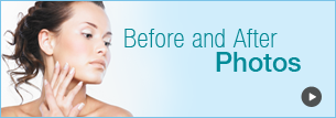 Facial plastic surgery before and after photos